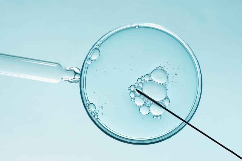 The tensions
underlying AI and IVF